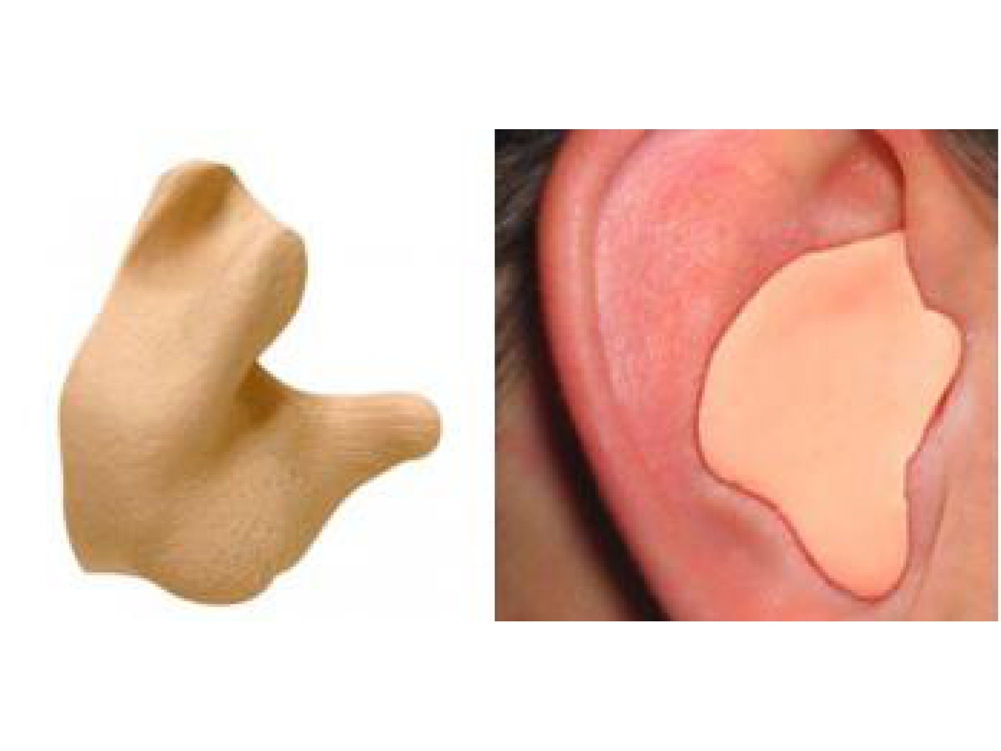 Radians Custom Molded Earplugs Tan | DIY Silicone Fit Kit